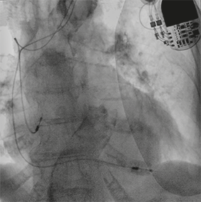 Moonray COMPACT cardiologia cardiologia