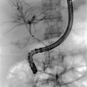 Moonray COMPACT digestive endoscopy digestive endoscopy